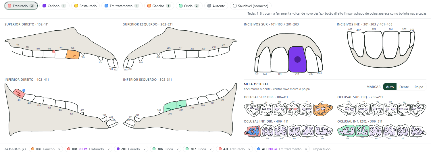 Odontograma anatômico equino: arcadas laterais, incisivos, mesa oclusal e achados marcados por dente e polpa